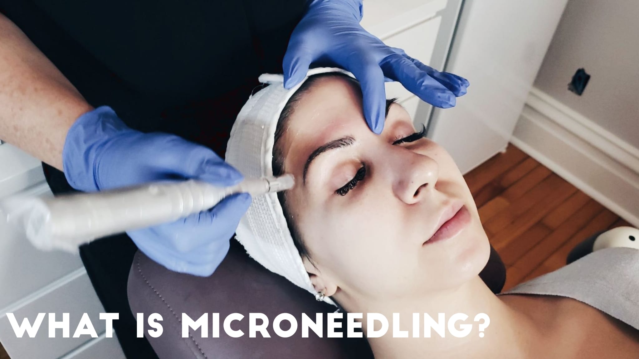 what is Microneedling