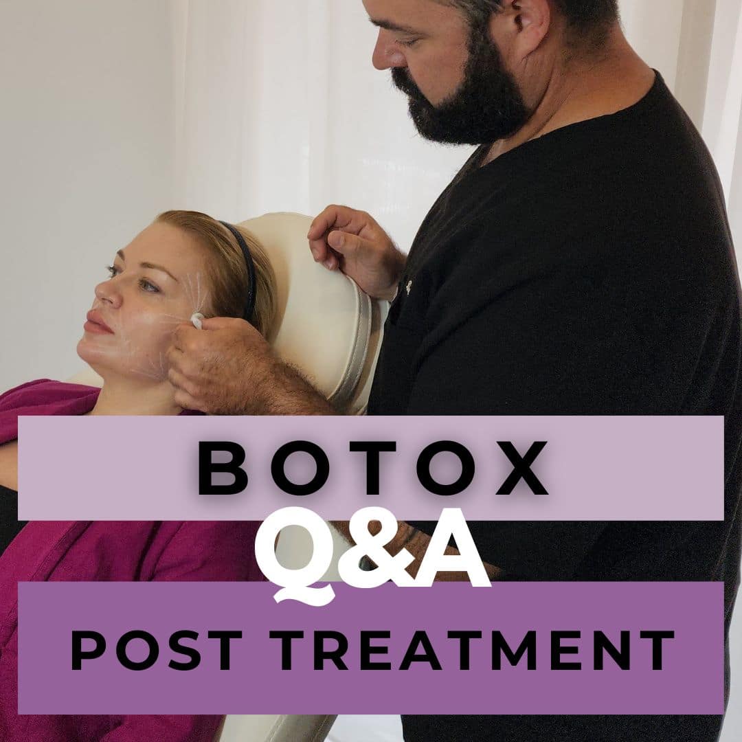 Botox Post Treatment