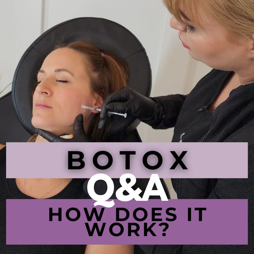 How Does Botox Work A Comprehensive Guide to Understanding Botox Treatments