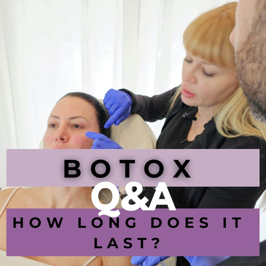 How long does Botox Last (2)