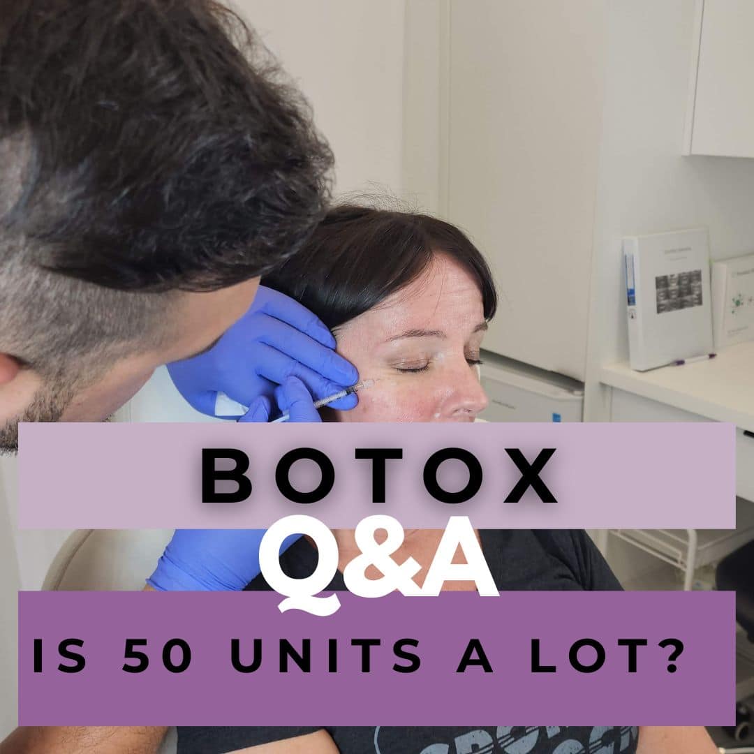 Is 50 units of Botox a lot?