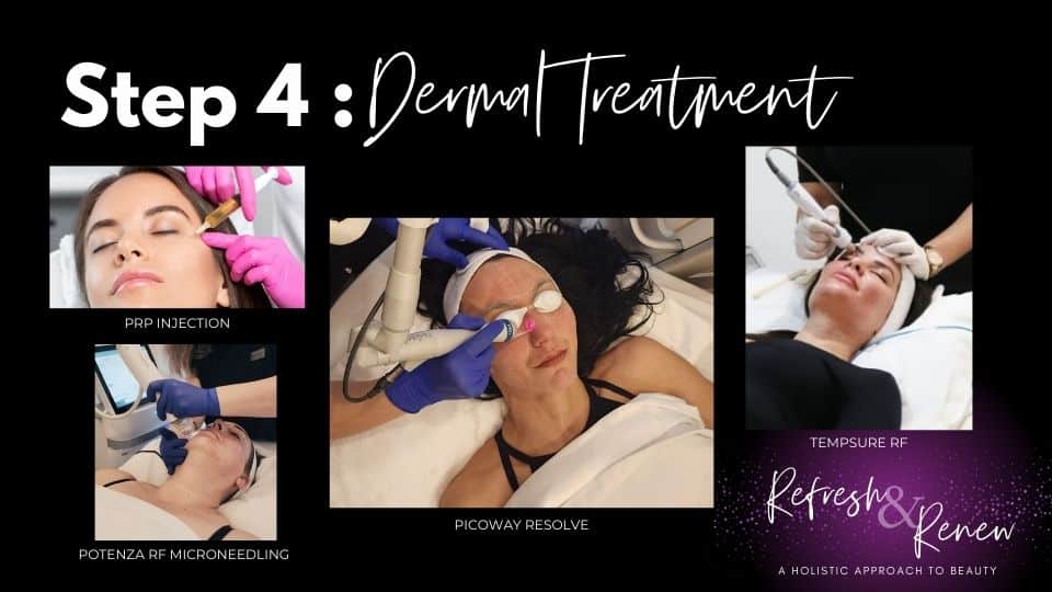 Step 4 Dermal Treatment