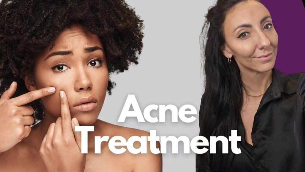 Acne Treatment Moncton