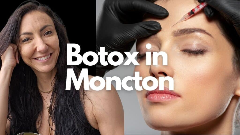 Botox Injections by Sparkle Lifestyle MediSpa. Botox Moncton