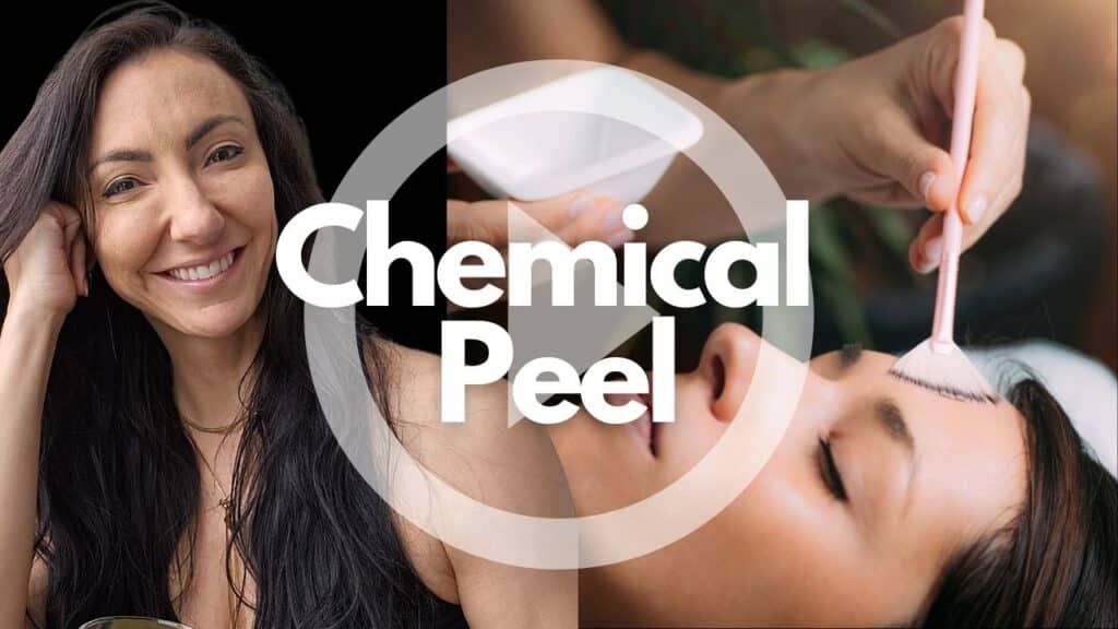 Chemical Peel Moncton NB