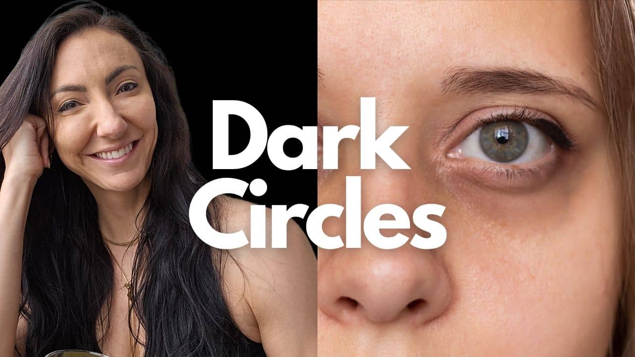 Dark Circles Treatments