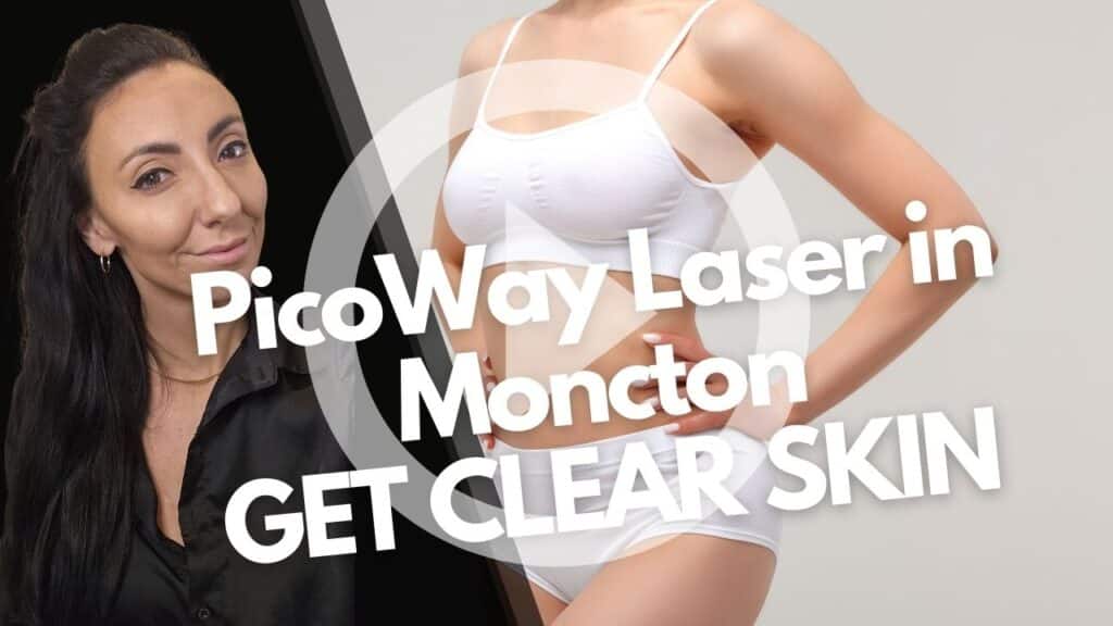 PicoWay Laser Moncton NB