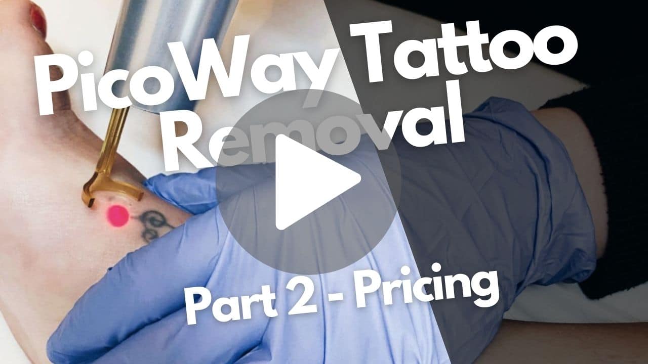 How much does PicoWay Tattoo Removal Cost_ Sparkle Lifestyle & MediSpa