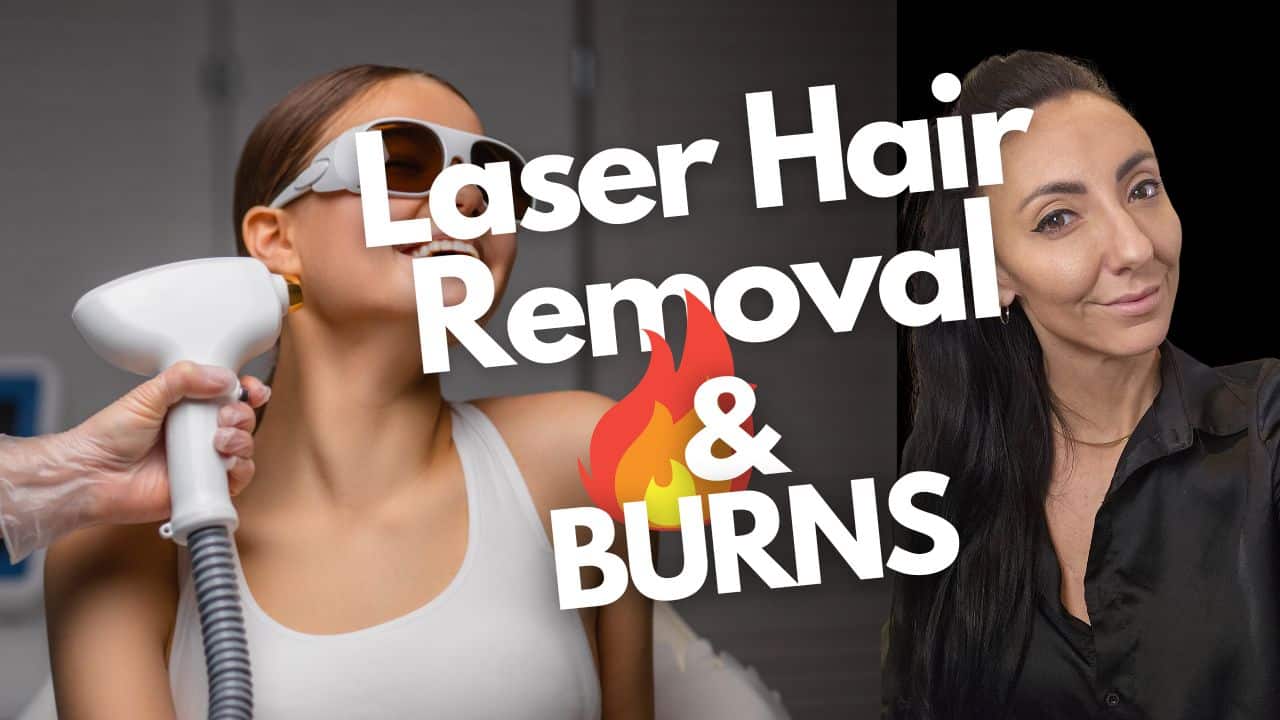 Laser Hair Removal Burns Causes, Prevention, and Treatment Tips