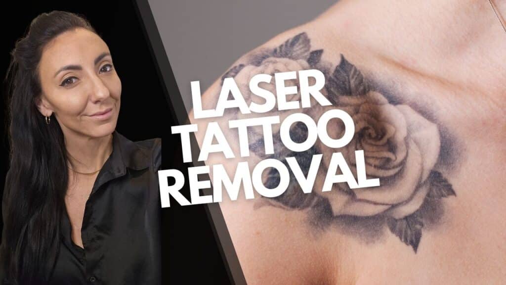 Laser Tattoo Removal
