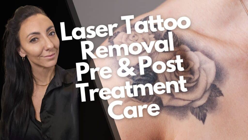 Laser Tattoo Removal Pre & Post Treatment Care