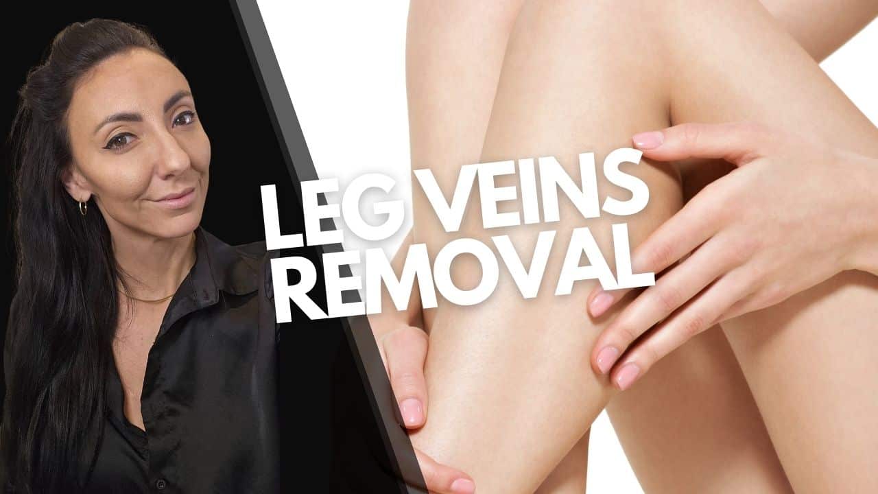 Leg Veins Removal