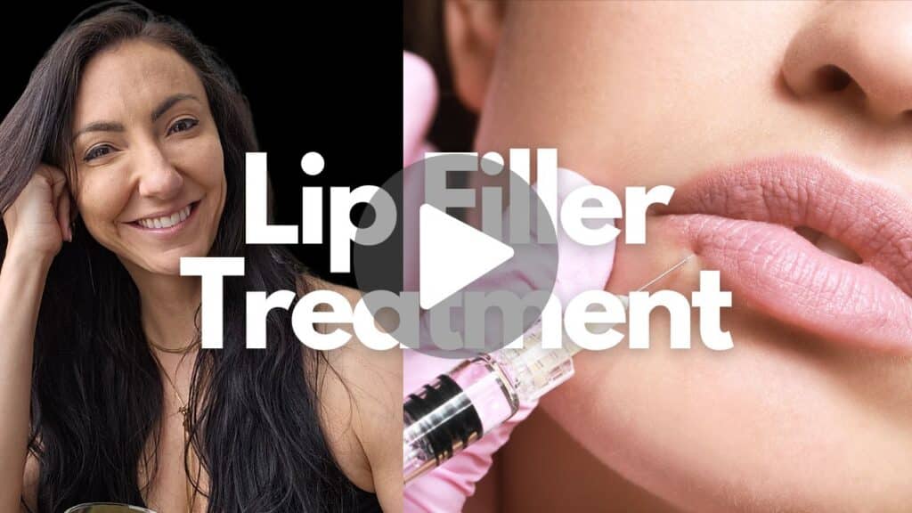 Lip Fillers Treatment in Moncton NB Sparkle Lifestyle Medispa