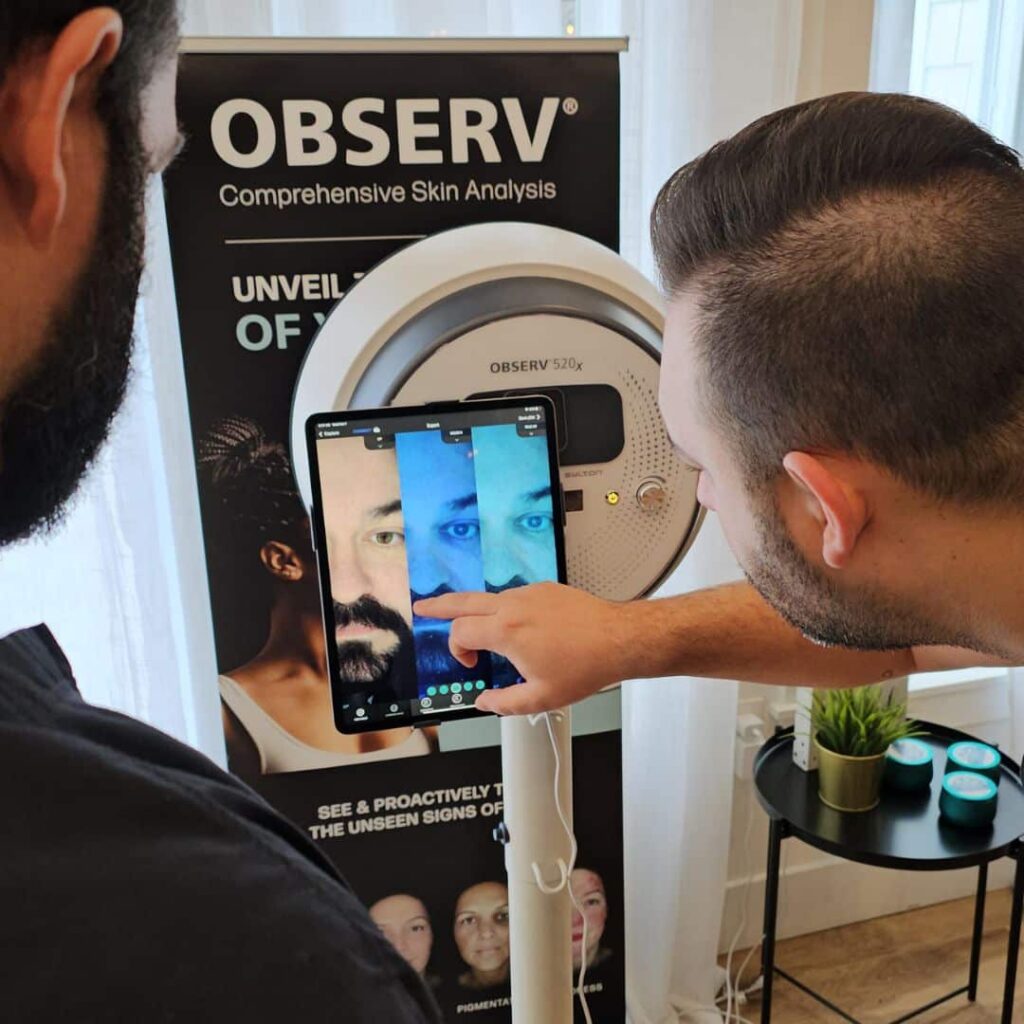 Observ-Skin-Analysis-Moncton