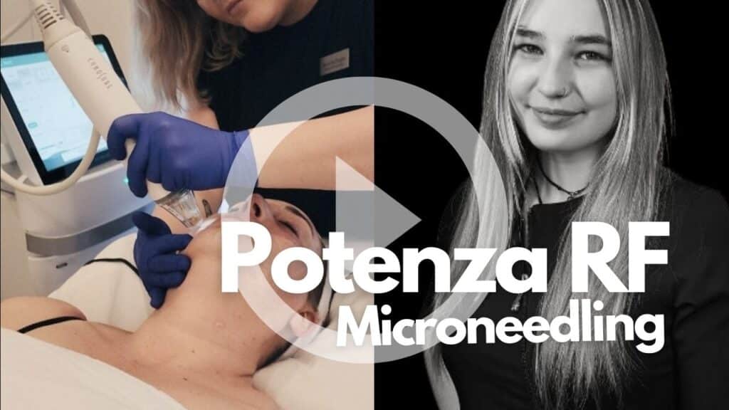 Potenza RF Microneedling_ The Ultimate Skin Tightening and Rejuvenation Treatment