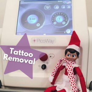 Tattoo Removal