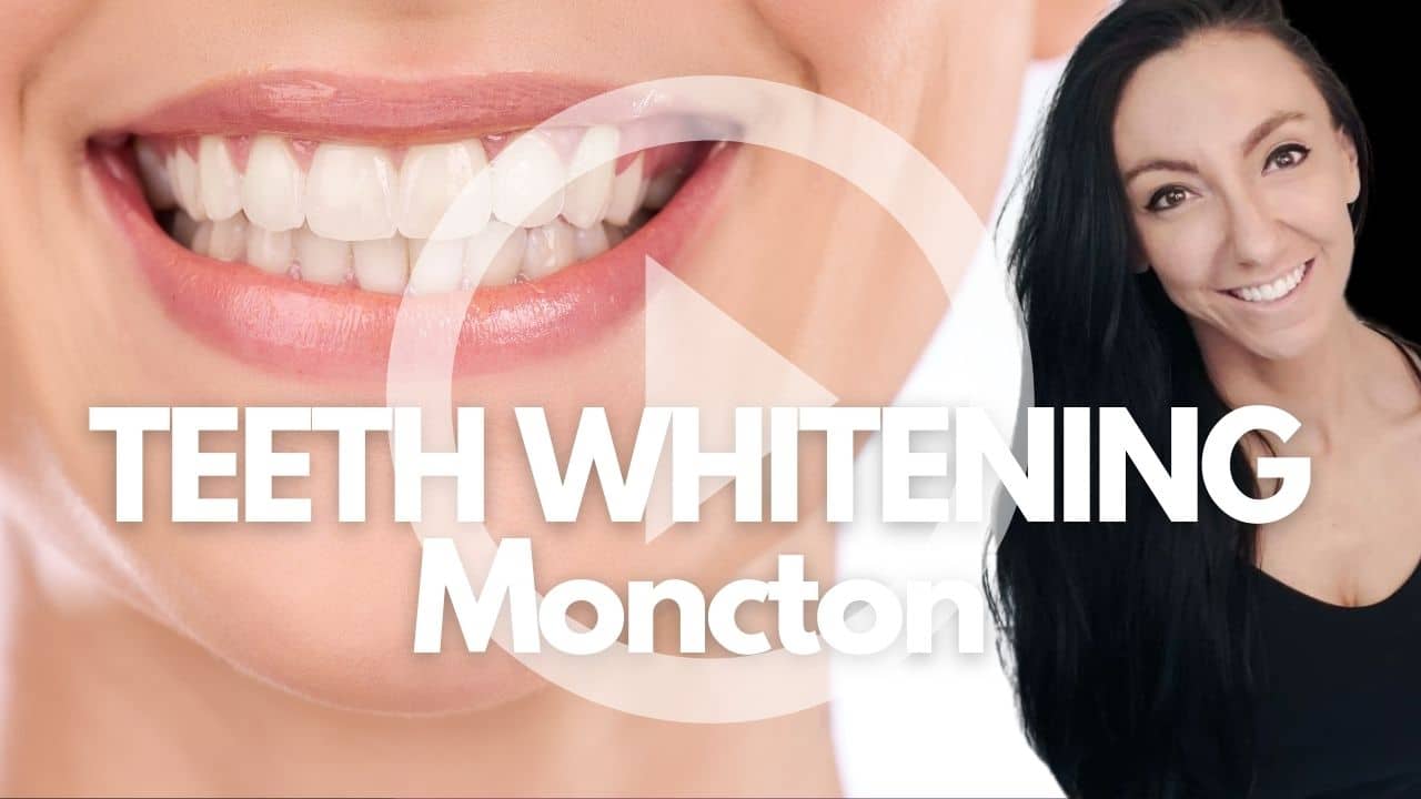 Teeth Whitening Moncton