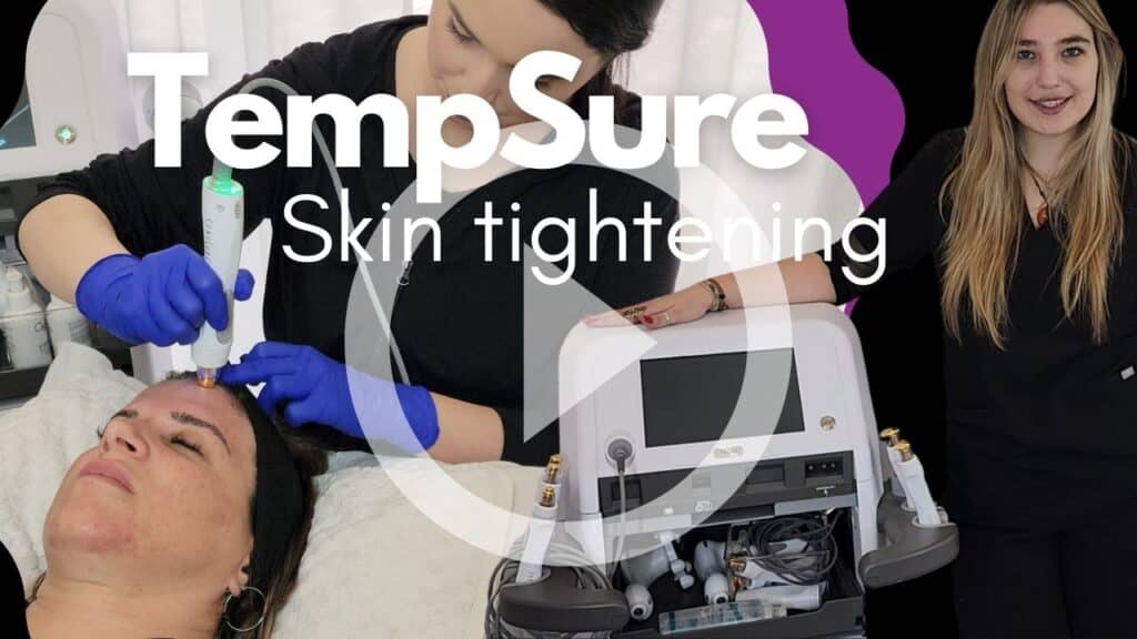 TempSure RF Skin Tightening Moncton NB Sparkle Lifestyle & MediSpa