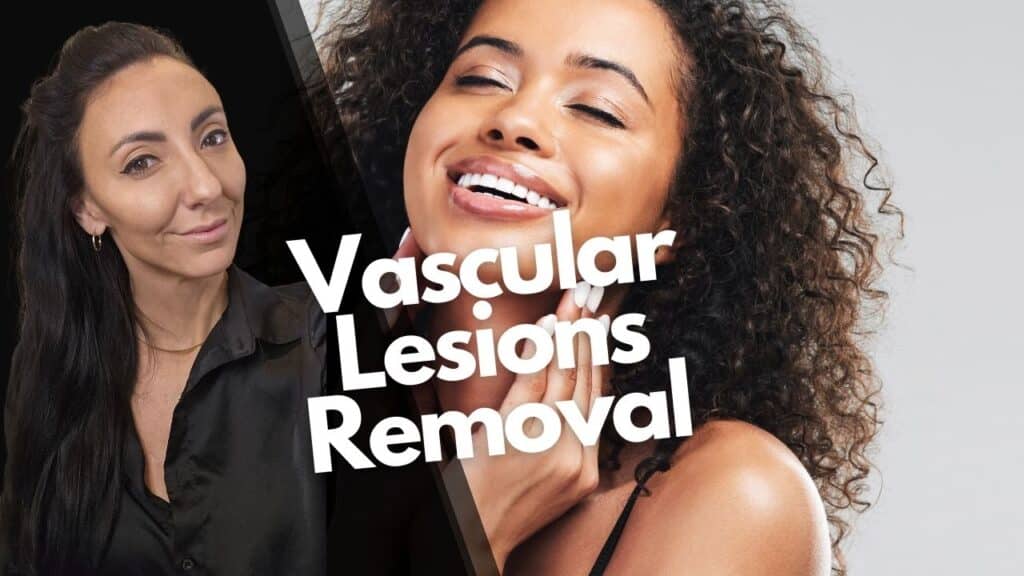 Vascular Lesions Removal