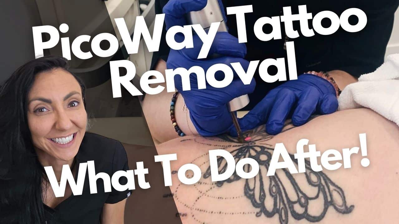 What to do after your PicoWay Tattoo Removal Session