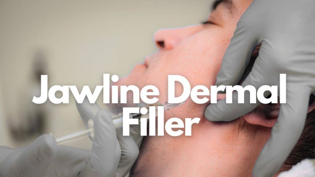 Jawline Dermal Filler Treatment