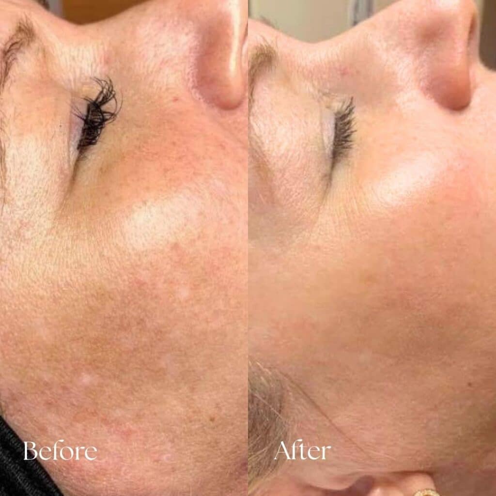 Before & After Skincare (1)