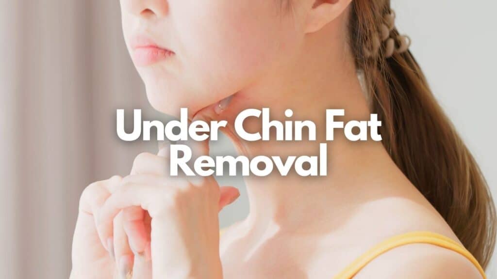 Underchin Fat Removal