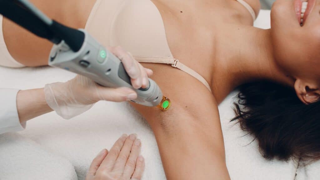 Laser Hair Removal Moncton NB Sparkle MediSpa