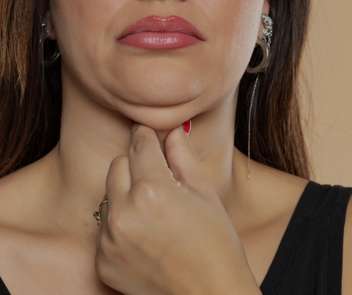 Belkyra Cost in Canada 1 Belkyra Cost in Canada