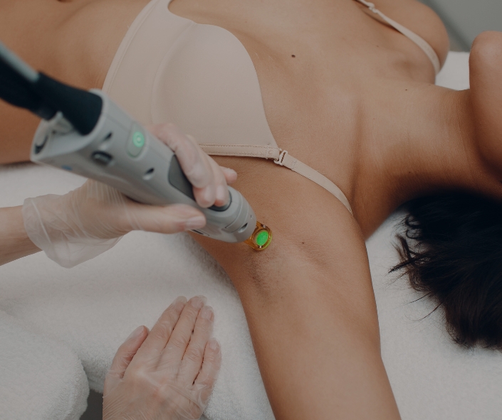 Laser Hair Removal in Moncton & Dieppe: Ditch the Razor, Embrace Confident Skin 1 Best Laser Hair Removal Moncton & Dieppe