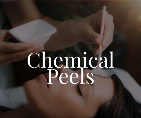 Chemical Peel 1 Chemical Peel Moncton NB Sparkle MediSpaMoncton