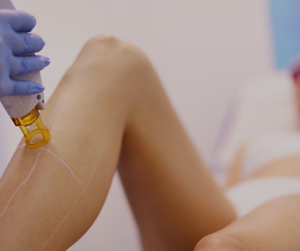 Laser Hair Removal and Pregnancy 2 How to get ready for your first laser hair removal appointment