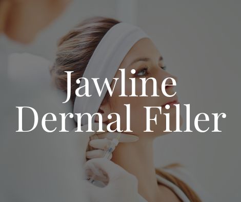 Jawline Dermal Filler Treatment Moncton Sparkle