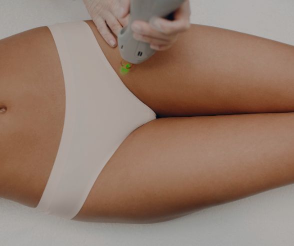 How to prepare for laser hair removal 1 Laser Hair Removal Gentle Max Pro Laser Moncton NB