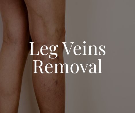 Leg Veins Removal 1 Leg Veins Removal Treatment Moncton NB Sparkle