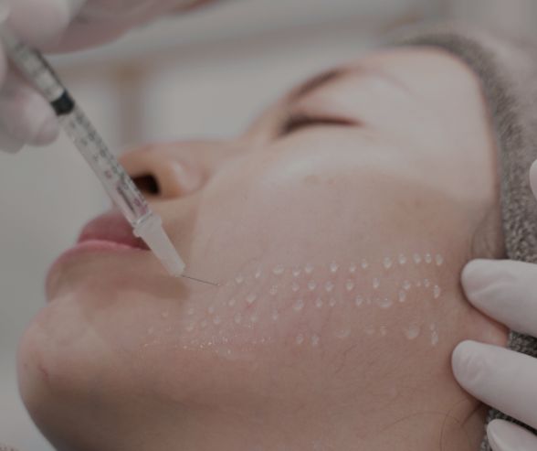 PRP Treatment in Moncton 10 Mesotherapy Treatment Moncton NB Sparkle MediSpa