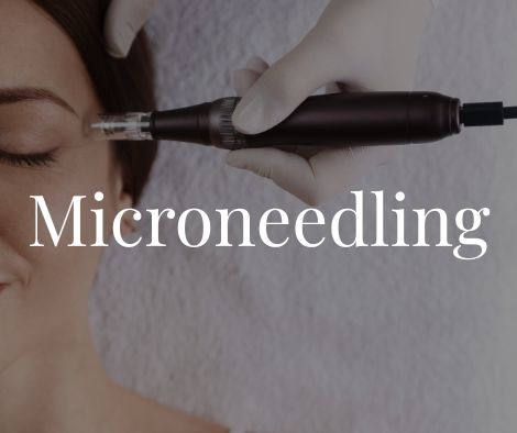 Microneedling Moncton