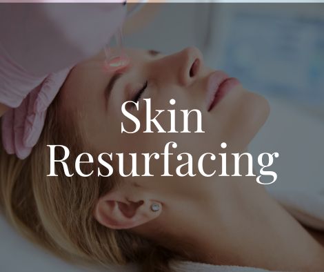 Best Laser Skin Resurfacing Moncton 1 Skin Resurfacing Laser Moncton Sparkle