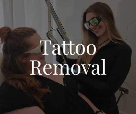 Tattoo Removal Moncton 1 Tattoo Removal Moncton