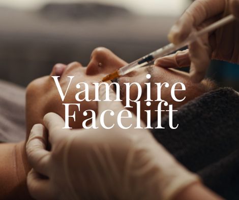 Vampire Facelift Treatment Moncton NB