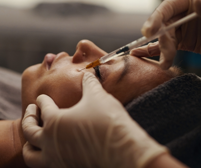 Botox Pre-Care 1 Vampire Facial Treatment Moncton NB 2