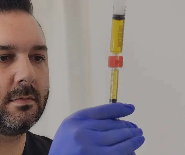 Best PRP Treatment Moncton Sparkle MediSpa Moncton NB