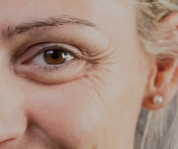 Best Wrinkle & Fine Line Treatment Moncton