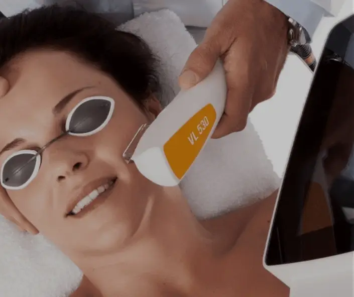 IPL Photofacial