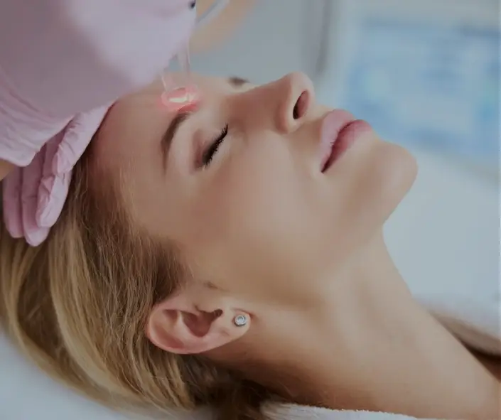 Skin Resurfacing Laser Moncton Sparkle