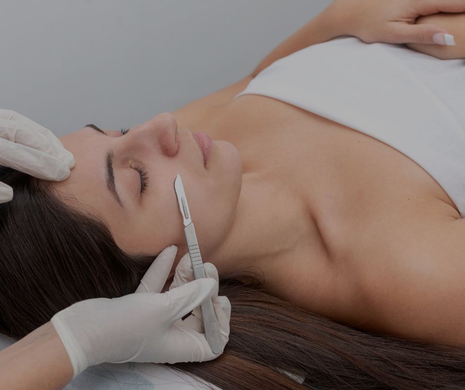 Dermaplaning in Moncton & Dieppe 1 Dermaplanning Moncton Sparkle MediSpa