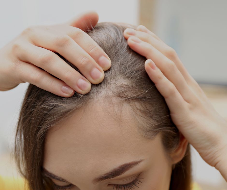 PRP Treatment in Moncton & Dieppe 3 PRP for Hair Loss