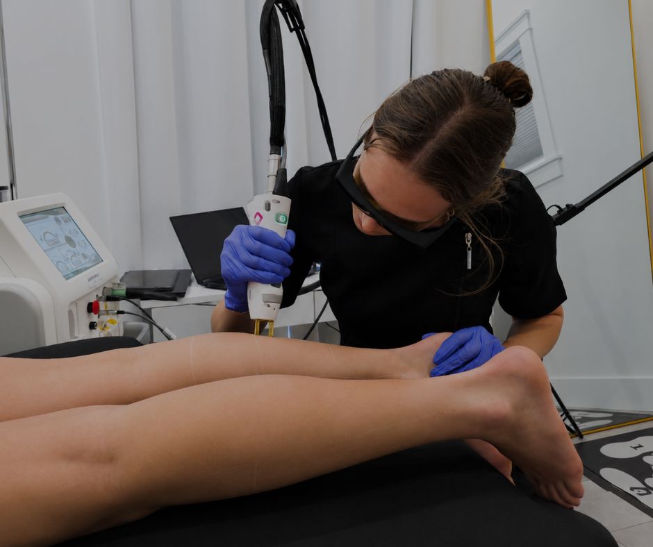 Laser Hair Removal Moncton Dieppe NB 1 Laser Hair Removal Moncton NB Gentle Max Pro Sparkle Lifestyle MediSpa