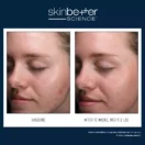 WFP-400304-W23-SKB-BA-2000x2000_0002_AlphaRet Clearing Serum EN