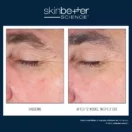 WFP-400304-W23-SKB-BA-2000x2000_0010_EyeMax AlphaRet Overnight Cream EN